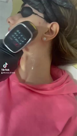 New Technology- TOP !!! Grazie alla nostra brand ambassador @user5947725167420 #laserhairremoval #noleggiolase #epilazionelaser