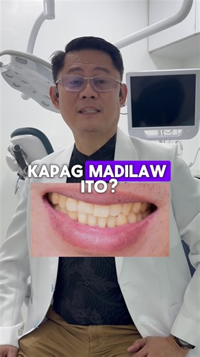 Madilaw na Ngipin = Matibay??? 😬👨🏻‍⚕️🦷 #DiverseOralCore #DentalClinic #DentalCare #YellowTeeth