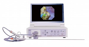 [Hot Item] Semi Rigid Digital Ureteroscope Transureteroscopic Lithotripsy for Adult Electronic Ureteroscopic Ureterorenoscopy Endoscope