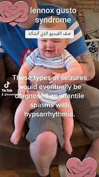 Lennox-Gastaut Syndrome