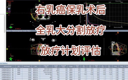 手把手教！乳腺癌保乳术后全乳大分割放疗放疗计划评估方法