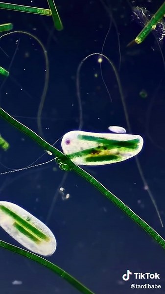 Fascinating Feeding Behavior of Frontonia Protozoa