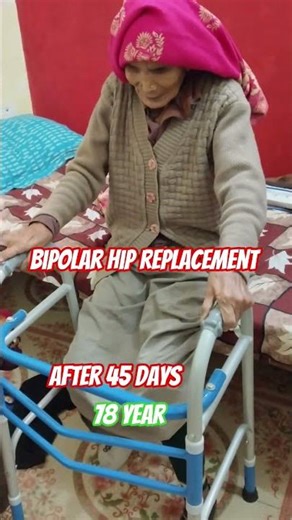 bipolar hip replacement exercise#mathura after 45 days #mathura# 78 year old hip change