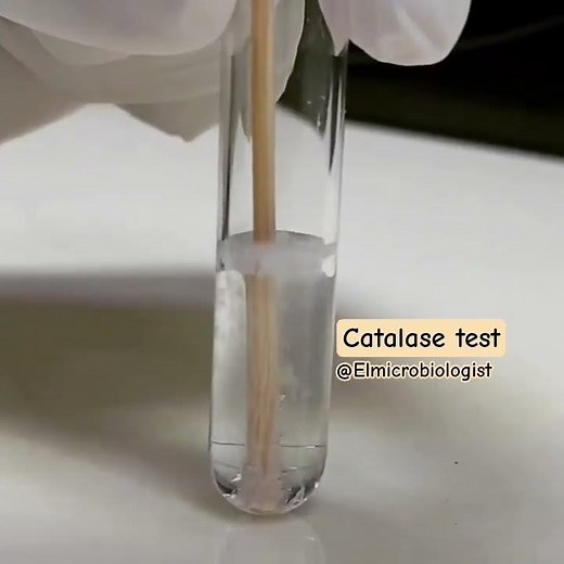 Catalase biochemical test in medical microbiology laboratory for bacteria identification