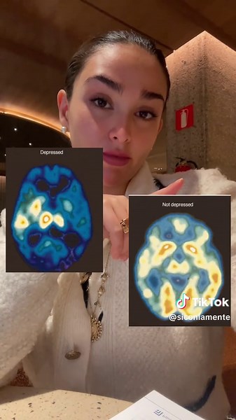 La conexión entre depresión y el cerebro humano
