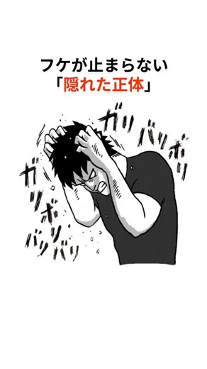 【衝撃】洗うほど増える？フケが止まらない「隠れた正体」♯雑学#健康 #フケ対策 #頭皮ケア #スキンケア #ライフハック #予防医学
