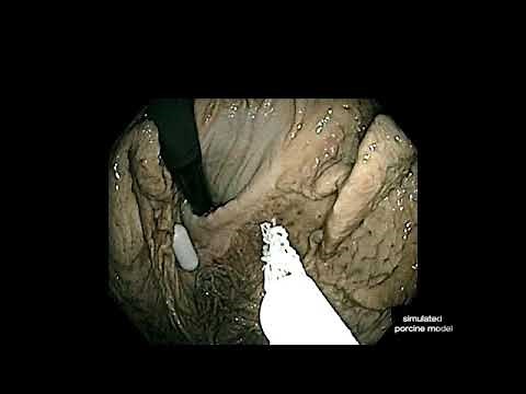 ROTH NET™ Retriever - 360: Clinical Video