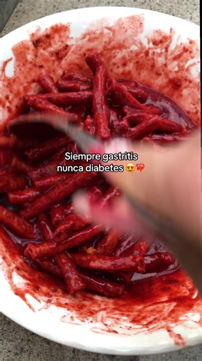 #🤤 #parati #viraltiktok # | siempre gastritis nunca diabetes