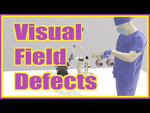 Visual Field Defects - FUN, SIMPLE, and MEMORABLE!