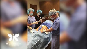 Cellfina for Cellulite Reduction: Watch This In-Office Procedure