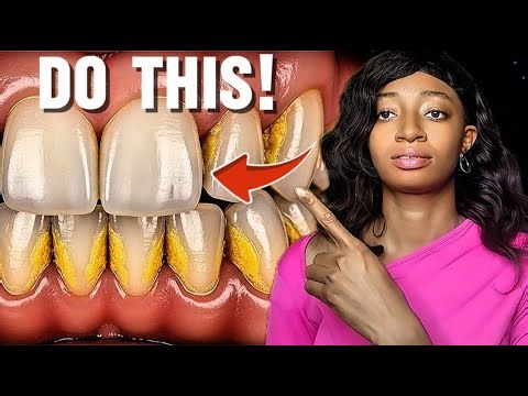 1 Best Way To Stop Tartar Buildup (Do This At Home)