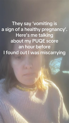 Understanding Hyperemesis Gravidarum and Pregnancy Loss