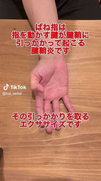 親指ばね指の治療法と改善ストレッチ