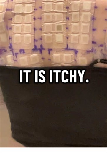 Day 2 of Patch Testing Update: Managing Nail Allergy