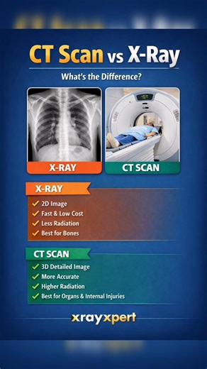 CT Scan vs X-Ray 🤔Know the difference before your next test!Right test = Better diagnosis ✅