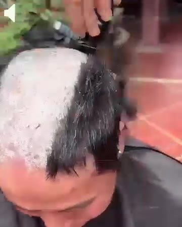 Recurring dermatitis, flaking and cracking from psoriasis, itchy and tight scalp, stinging pain, red rashes in private areas, even joint soreness and nerve-related discomfort? These symptoms might seem unrelated, but they often come from the same root cause: a damaged skin barrier and chronic inflammation in the body. Just stopping the itch only deals with the surface — what really works is deeper repair, anti-inflammatory care, and calming the nerves. 💧 That’s exactly why we recommend the Magn