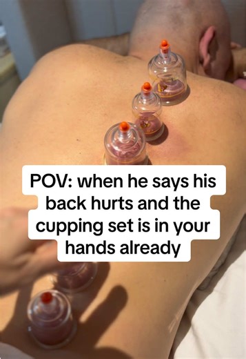 Cupping Therapy for Back Pain Relief: A POV Experience