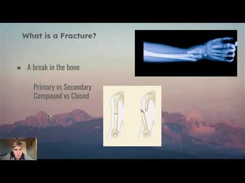 Types of Bone Fractures | Nursing