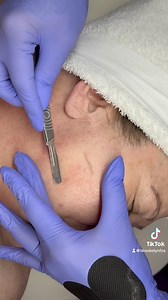 ✨Dermaplaning is an amazing form of exfoliation for even the most sensitive skin. This removes all outer layers of dead skin and hair leading to a smoother, brighter, and more radiant complexion ✨ | Beautiful Brows & Esthetics