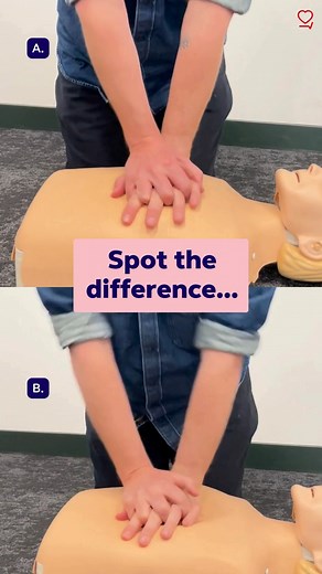 💡 CPR tip: When doing chest compressions, lock your elbows and keep your arms straight, just like in clip A. Think of it as using your whole body, not just your arms. The motion should come from your hips, helping you use your body weight to press down with strength and control. If your arms are bent, the movement relies more on upper body strength which can make compressions less effective and cause quicker fatigue. | Resuscitation Council UK