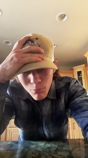 Georgie Young Sheldon Face Scar Revelation