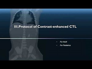 CT lymphangiography Dr Ahmed abd elsamed