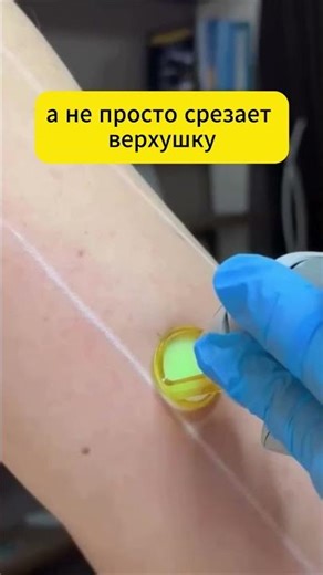Как избавиться от волос на лице, читай в описании