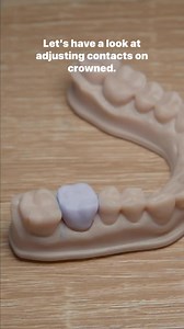 2.3K views · 60 reactions | Adjusting contacts for indirects can help...