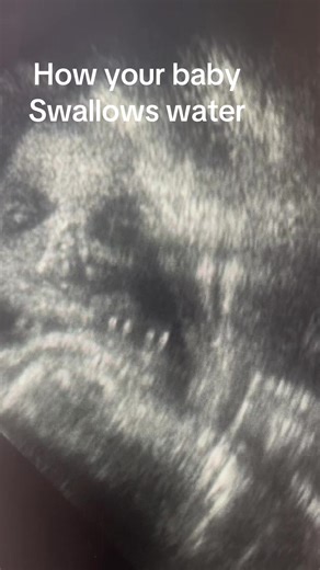 How Your Baby Swallows Water in the Womb