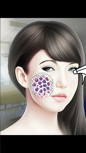 ASMR Treatment Removal and Pulling Out Maggots from Face Animation Part 1