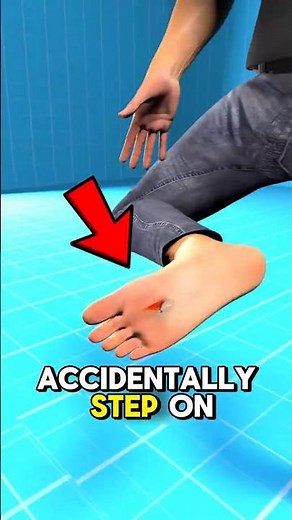 Safest Way to Remove Glass From Your Foot at Home!😮