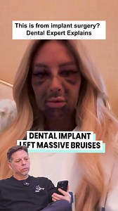 4th day after "All-on-4", and this level of bruising? That isn’t normal. Some swelling is expected, but this much trauma isn’t. Severe bruising across the face and neck can be a sign of overly aggressive surgery or another issue that needs attention. If this is happening to you or someone you know, please don’t ignore it. Reach out to your surgeon immediately and get answers. #dentist #surgery #implants #meded #allonfours #smile #oralcare #gonewrong #redflag | Dr. Stuart Youmans