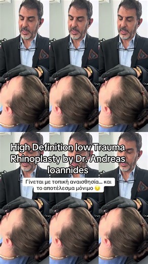 #beforeafter #πλαστικοσχειρουργοσ #beforeandafter