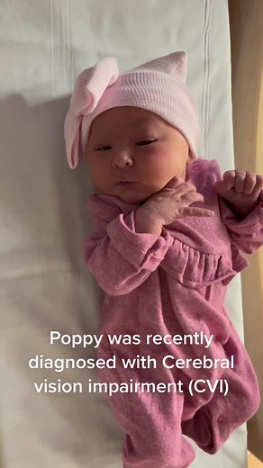 A new diagnosis along with the microcephaly and ACC. #cerebralvisualimparment #cvi #agenesisofthecorpuscallosum #acc #microcephaly