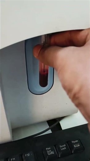 complete blood picture#cbptest#hematology #science #trading #bloodsample #labtechnician