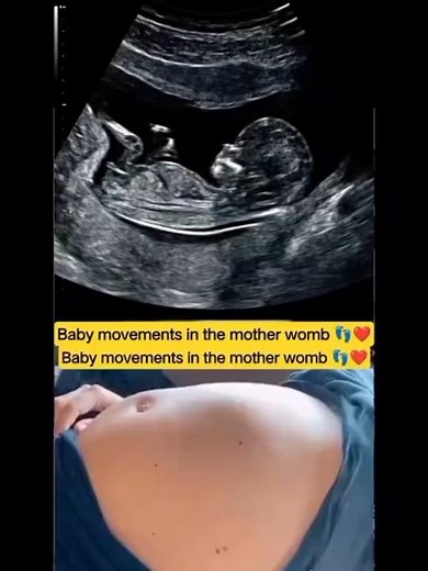 Baby Movements in the Mother's Womb | Amazing Fetal Movement During Pregnancy
