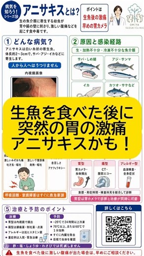 生魚の後に激しい腹痛！アニサキス症とは？｜病気を知ろう！第18弾