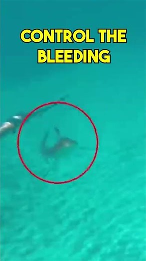 Shark Attacks: If You See a Shark 🦈 #sharkattack #firstaid