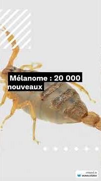 Ce que personne ne dit sur le grain de beauté dangereux — règle ABCDE