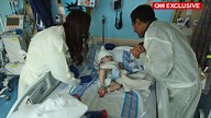 Video: Newly separated conjoined twins 'ahead of schedule'