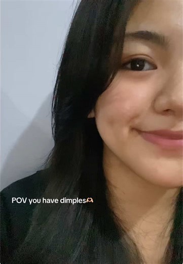 Understanding Dimples and Their Charm