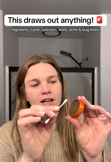 I can’t wait to start using this drawing salve when I’m not pregnant anymore! #PRID #drawingslave #firstaidmusthaves #firstaidessentials #firstaidkit