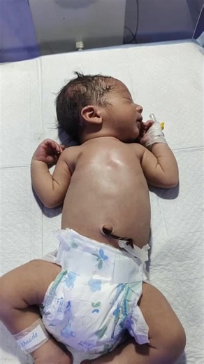 3.8K views · 378 reactions | Baby week up moment ❣️ All videos are shared with proper consent and are meant to promote knowledge and understanding of neonatal care practices. Viewer discretion is advised, as some medical scenes may be sensitive for certain audiences. #NICUDischarge #NewbornCare #BabyObservation #NICUNurse #DischargeProcess #HealthyBaby #NeonatalCare #BabyCareTips #NICULife #HospitalCare #MedicalEducationIndia #HealthcareProfessionals | Dr Zaib | Facebook