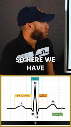 The Paramedic Coach ® on Instagram: "Breaking down the ECG for you! #ecg #paramedic #emts #paramedicschool"