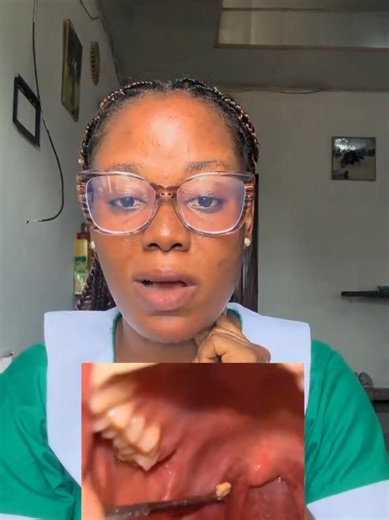 This is just Educational content, Like and Comment for more content like this.#nurse #fyp #viral #ghanahealthservice #pregnancy