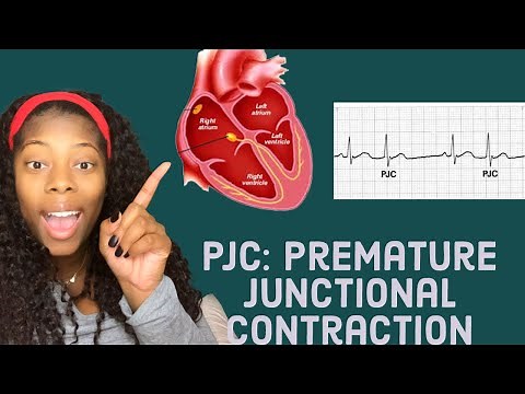 Basic EKG: Identifying premature junctional contractions- PJCS