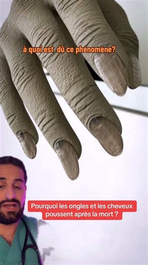 108K views · 1.3K reactions | Reconnaitre et diagnostiquer la mort est très important. #medical #sante #docteur #science #apprendresur#explication #vulgarisation #hopital #ongles #manucure #incroyable | Dr Anesthesia | Facebook
