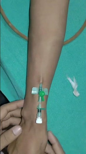 IV Cannulation Techniques Step by Step | Peripheral IV Cannula Insertion | #shorts | ICU & Emergency