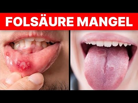5 häufige Anzeichen für einen Mangel an Folsäure im Körper!