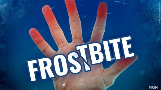 Identifying the signs of Frostbite - Local News 8